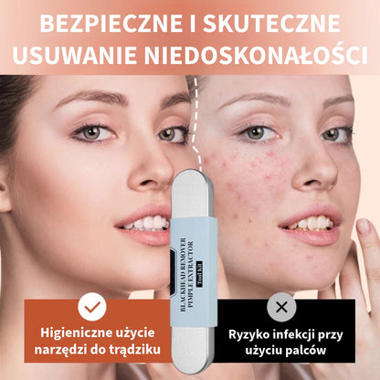 Zestaw ze Stali Nierdzewnej do Usuwania Wągrów